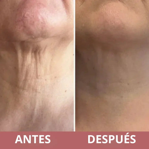 MASAJEADOR/Antiarrugas Rodillo 3D Integrado - Específico para cuello y rostro